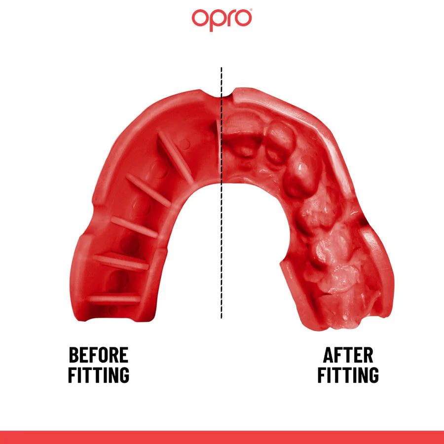 OPRO - Bronze Level Mouthguard (Youth|Adult)