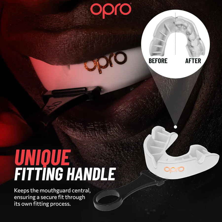 UFC - 青銅 - 護齒(成人)