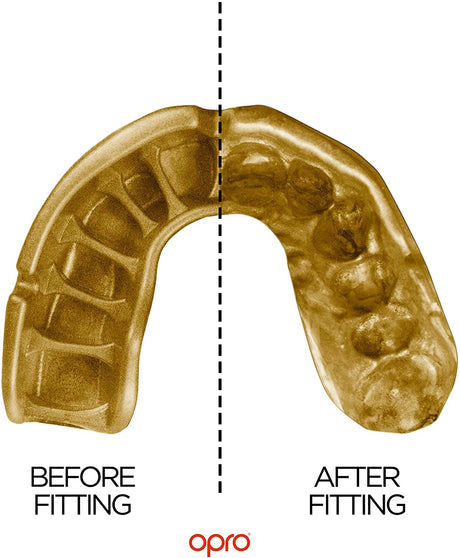 Gold Level mouthguard - (Adult)-Streamline Sports