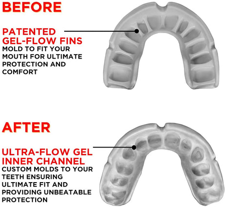 Gold Level mouthguard - (Junior)-Streamline Sports