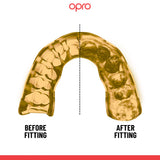*NEW* OPRO - Instant Custom-Fit Mouthguard - Hong Kong