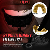 Gold Braces Mouthguard